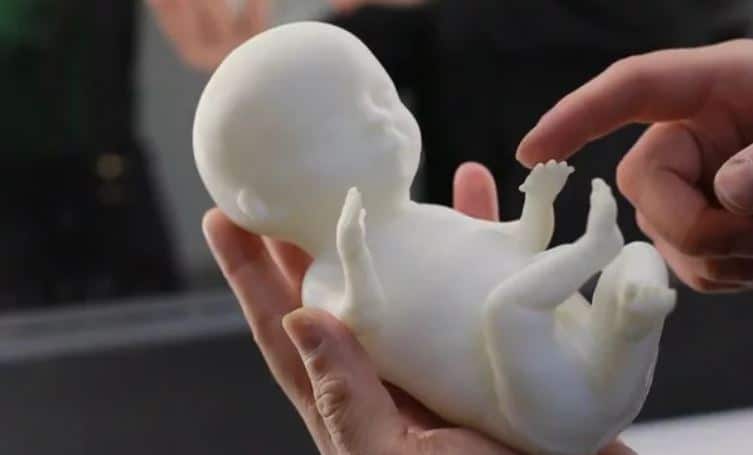 Pregnant Mums Can Now 3D PRINT Their Baby Scan!