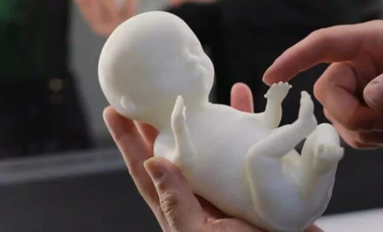 3dfoetus.jpg