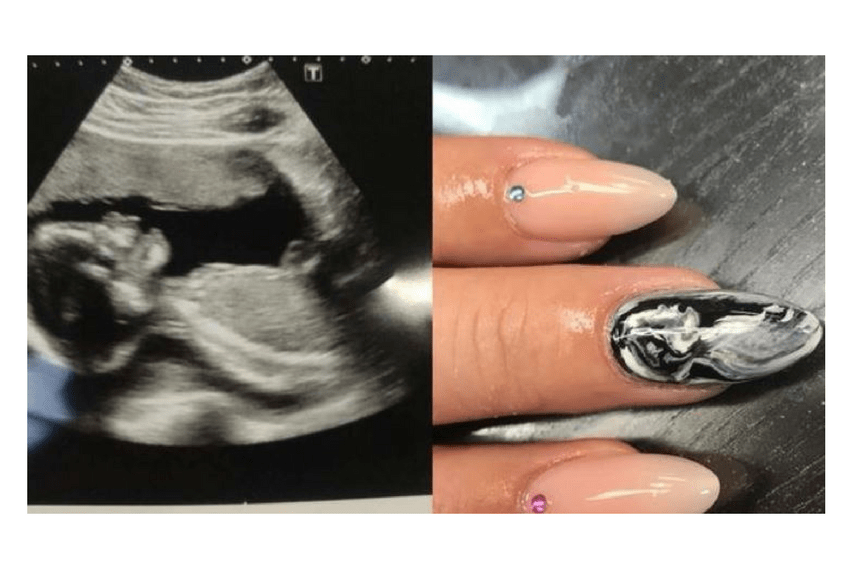 Baby Scan Painted Onto Mum-To-Be's Nails!