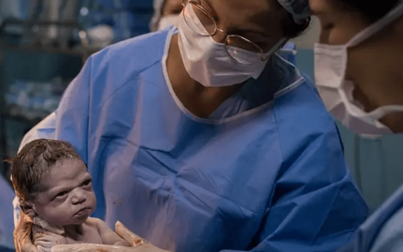 Newborn Captured Scowling at Surgeon During C-Section!