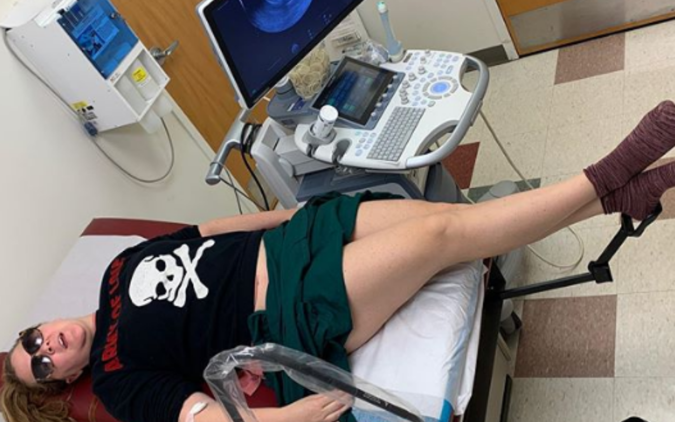 Amy Schumer Reveals Her IVF Journey in Bid For Second Baby
