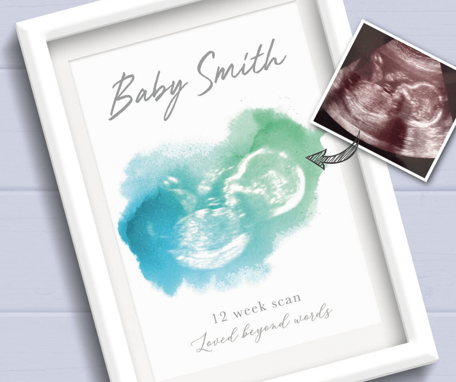 baby scan art