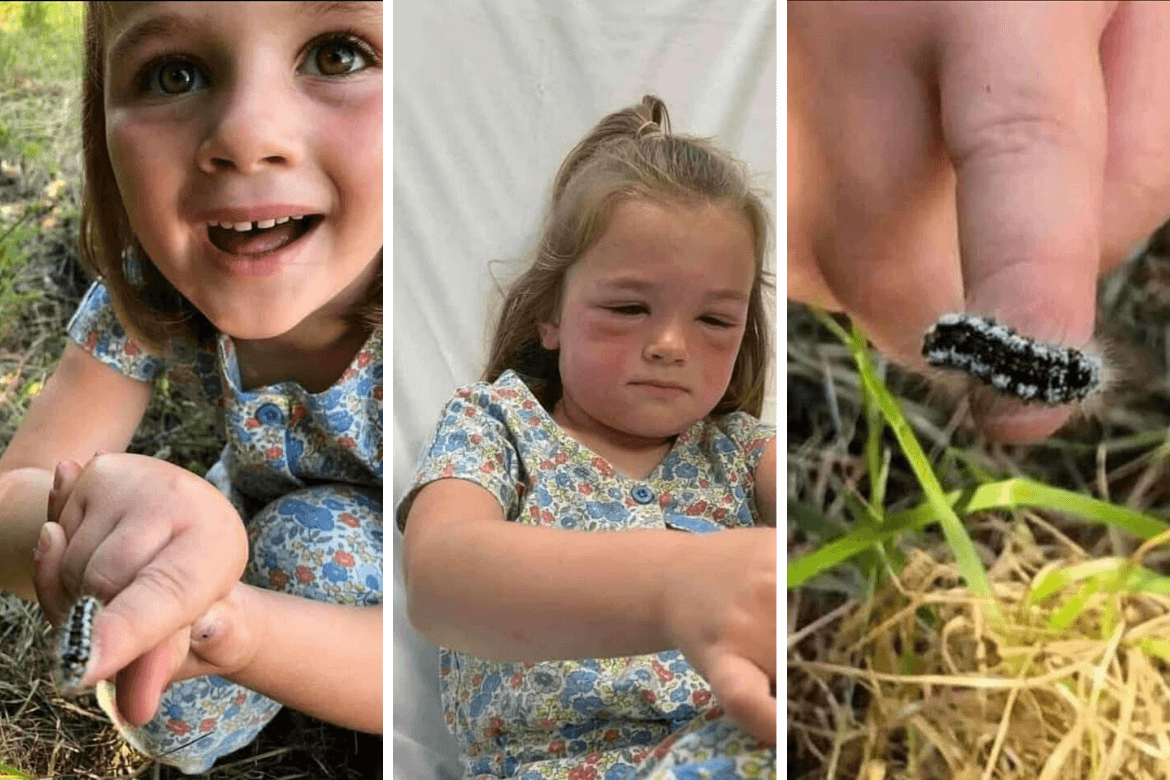 Mum's Warning After Her Little Girl's Allergic Reaction to Caterpillar