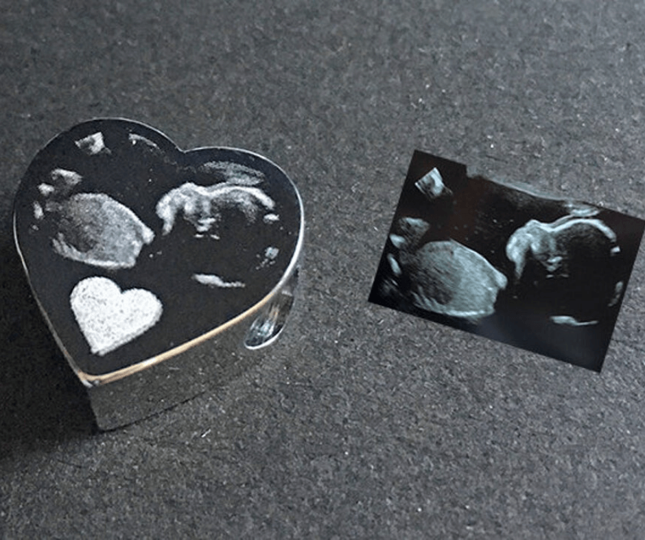 engraved ultrasound charm