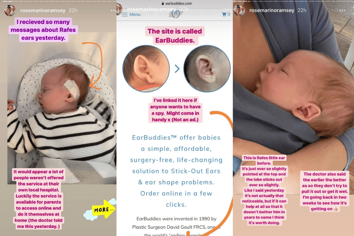 Rosie Ramsey Speaks Up About Newborn's Ear Adjustment