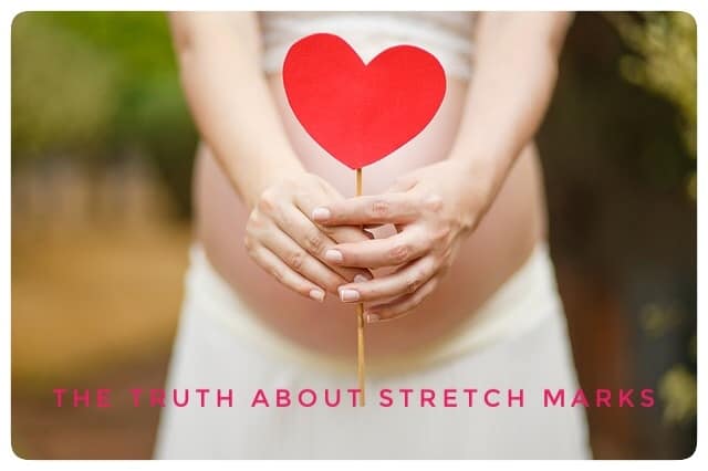 The Truth About Stretch Marks